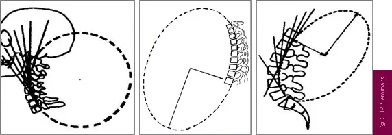 Chiropractic Durham NC Ideal Neck Geometry