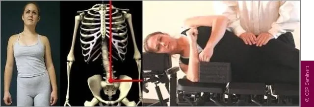 Chiropractic Durham NC Mirror Image Adjustment Example