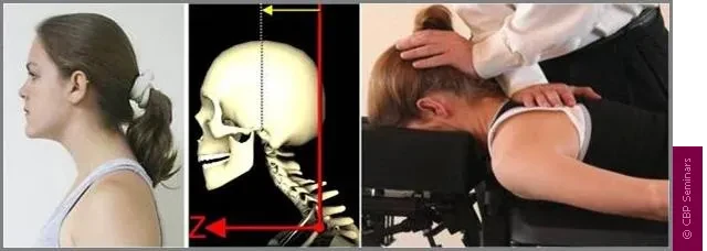 Chiropractic Durham NC Mirror Image Adjustment Example