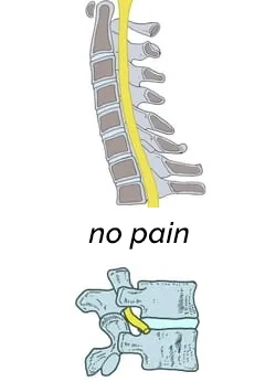 Chiropractic Durham NC No Pain