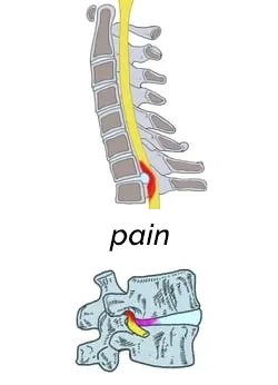 Chiropractic Durham NC Pain