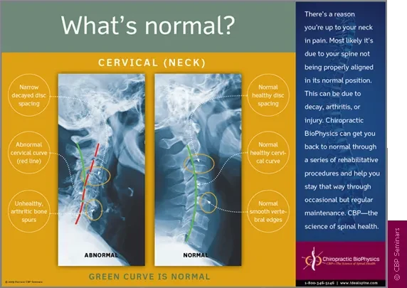 Chiropractic Durham NC What's Normal